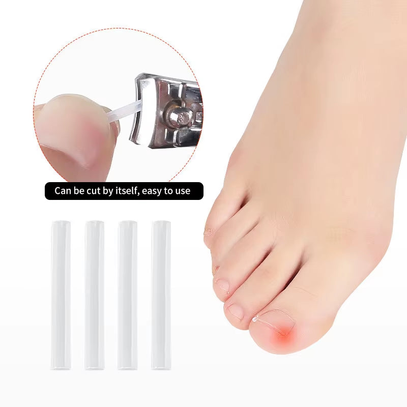 50Pcs/Box Ingrown Toenail Correction Strips Paronychia Correction Straightening Brace Toe Nail Treatment Groove Pedicure Tools